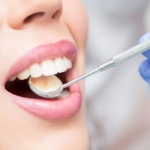 Д-р Вантова